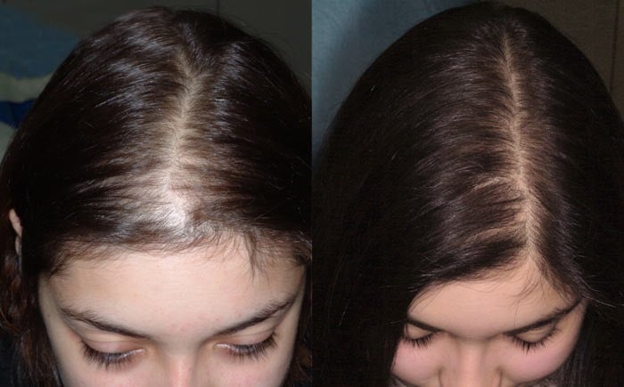 معایب ترمیم مو چیست مزایا و معایب ترمیم مو