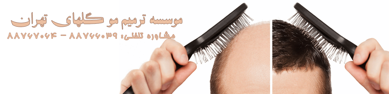 عوارض ترمیم مو گلهای تهران ترمیم موی بانوان و آقایان هزینه کاشت مو معایب روش ترمیم مو چیست عوارض کاشت مو